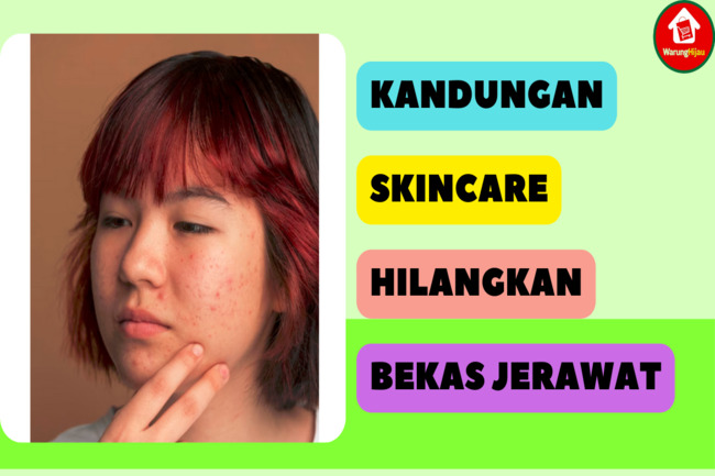 Warunghijau Kandungan Skincare Untuk Hilangkan Bekas Jerawat