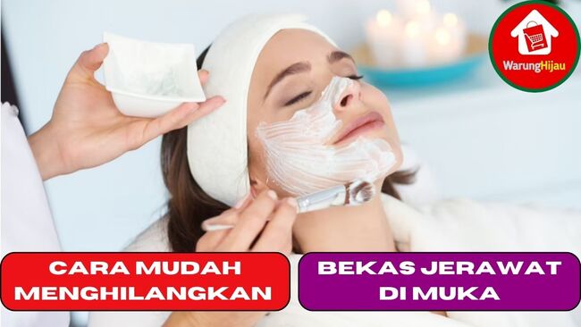 8 Cara Mudah Menghilangkan Bekas Jerawat di Muka