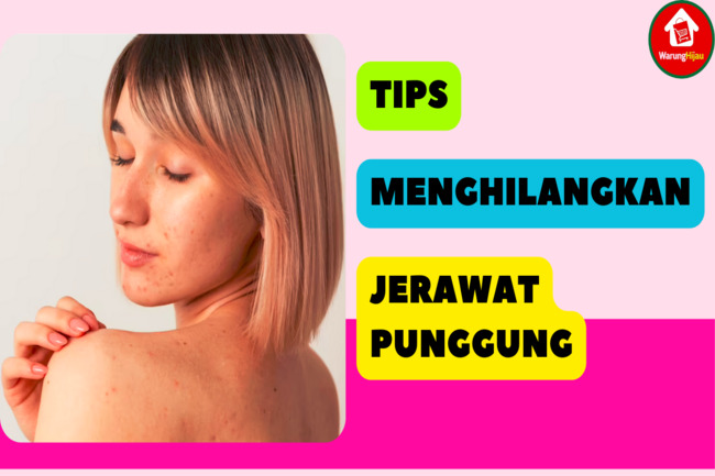 10 Tips Jitu Hilangkan Jerawat di Punggung yang Bisa Dicoba