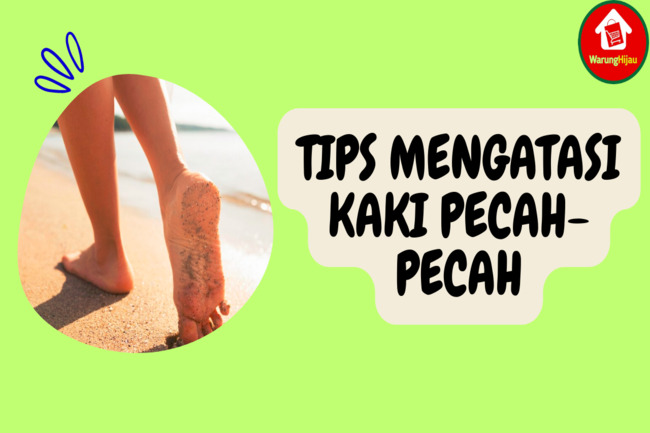 8 Tips Ampuh Atasi Kaki Pecah-Pecah supaya Kembali Lembut