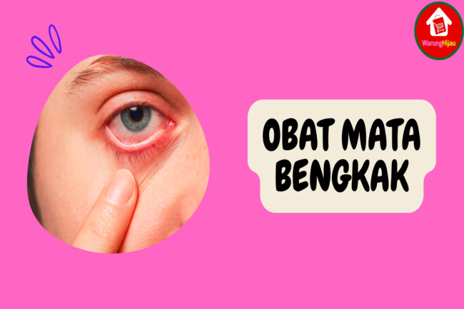 4 Obat Mata Bengkak yang Tepat untuk Setiap Penyebabnya